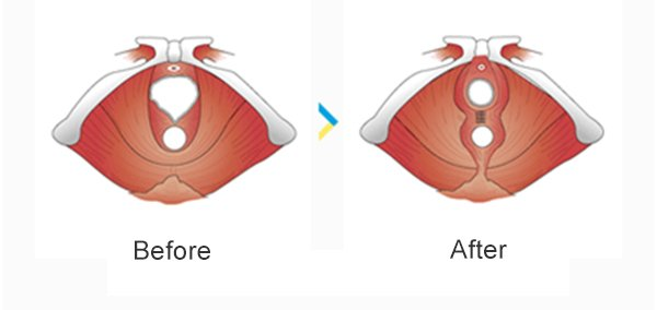 Hymenoplasty Clinic, Lahore